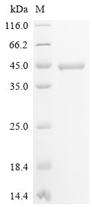 (Tris-Glycine gel) Discontinuous SDS-PAGE (reduced) with 5% enrichment gel and 15% separation gel.