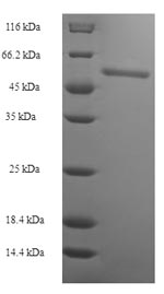 Recombinant Human GMP reductase 2 (GMPR2) – Figure 1 of 1