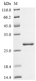 (Tris-Glycine gel) Discontinuous SDS-PAGE (reduced) with 5% enrichment gel and 15% separation gel.