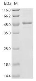 (Tris-Glycine gel) Discontinuous SDS-PAGE (reduced) with 5% enrichment gel and 15% separation gel.