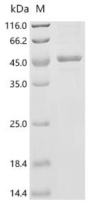 (Tris-Glycine gel) Discontinuous SDS-PAGE (reduced) with 5% enrichment gel and 15% separation gel.