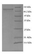 Recombinant Human Trichoplein keratin filament-binding protein (TCHP) – Figure 1 of 1