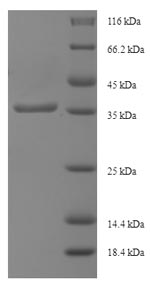 Recombinant Human Intraflagellar transport protein 27 homolog (IFT27) – Figure 1 of 1