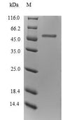 (Tris-Glycine gel) Discontinuous SDS-PAGE (reduced) with 5% enrichment gel and 15% separation gel.