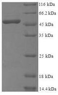 Recombinant Human 39S ribosomal protein L1, mitochondrial (MRPL1), partial – Figure 1 of 1