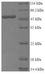 Recombinant Human 39S ribosomal protein L1, mitochondrial (MRPL1), partial – Figure 1 of 1