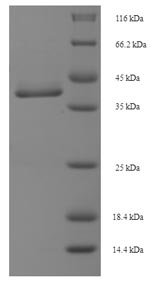 Recombinant Human Protein MIS12 homolog (MIS12) – Figure 1 of 1