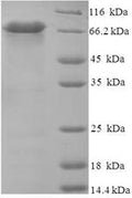 Recombinant Human Probable serine carboxypeptidase CPVL (CPVL) – Figure 1 of 1