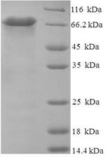 Recombinant Human Probable serine carboxypeptidase CPVL (CPVL) – Figure 1 of 1