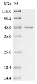 (Tris-Glycine gel) Discontinuous SDS-PAGE (reduced) with 5% enrichment gel and 15% separation gel.