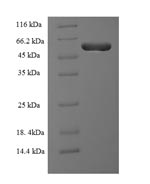 Recombinant Human Protein RMD5 homolog A (RMND5A) – Figure 1 of 1