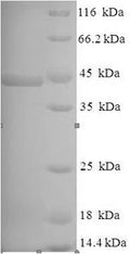 (Tris-Glycine gel) Discontinuous SDS-PAGE (reduced) with 5% enrichment gel and 15% separation gel.
