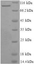 Recombinant Human Xaa-Pro aminopeptidase 1 (XPNPEP1) – Figure 1 of 1
