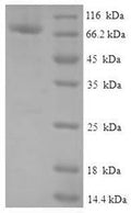 Recombinant Human Protein FAM114A2 (FAM114A2) – Figure 1 of 1