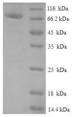Recombinant Human Protein FAM114A2 (FAM114A2) – Figure 1 of 1