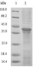 (Tris-Glycine gel) Discontinuous SDS-PAGE (reduced) with 5% enrichment gel and 15% separation gel.