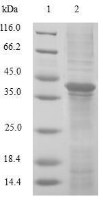 (Tris-Glycine gel) Discontinuous SDS-PAGE (reduced) with 5% enrichment gel and 15% separation gel.