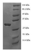 Recombinant Human p53 and DNA damage-regulated protein 1 (PDRG1) – Figure 1 of 1