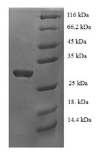 Recombinant Human p53 and DNA damage-regulated protein 1 (PDRG1) – Figure 1 of 1