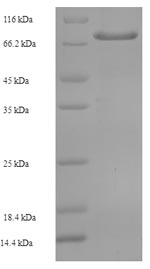Recombinant Human Transmembrane prolyl 4-hydroxylase (P4HTM), partial – Figure 1 of 1