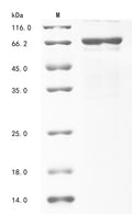 (Tris-Glycine gel) Discontinuous SDS-PAGE (reduced) with 5% enrichment gel and 15% separation gel.