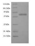 Recombinant Human Charged multivesicular body protein 5 (CHMP5) – Figure 1 of 1
