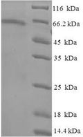 Recombinant Human Tubulin beta-6 chain (TUBB6) – Figure 1 of 1