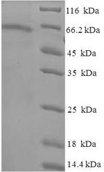 Recombinant Human Tubulin beta-6 chain (TUBB6) – Figure 1 of 1