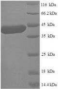 Recombinant Human Alpha N-terminal protein methyltransferase 1A (METTL11A) – Figure 1 of 1