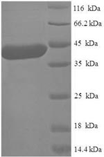 Recombinant Human Alpha N-terminal protein methyltransferase 1A (METTL11A) – Figure 1 of 1