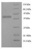 Recombinant Human Protein DGCR6L (DGCR6L) – Figure 1 of 1