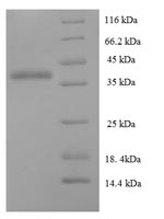 Recombinant Human Protein DGCR6L (DGCR6L) – Figure 1 of 1