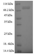 Recombinant Human E3 ubiquitin-protein ligase TRIM9 (TRIM9) – Figure 1 of 1
