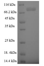 Recombinant Human E3 ubiquitin-protein ligase TRIM9 (TRIM9) – Figure 1 of 1