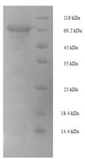 Recombinant Mouse Pancreatic secretory granule membrane major glycoprotein GP2 (Gp2) – Figure 1 of 1