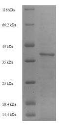 Recombinant Mouse Intercellular adhesion molecule 4 (Icam4), partial – Figure 1 of 1
