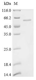 Recombinant Human Methyltransferase-like protein 17, mitochondrial (METTL17) – Figure 1 of 1