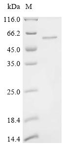 Recombinant Human Methyltransferase-like protein 17, mitochondrial (METTL17) – Figure 1 of 1