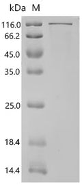 Recombinant Human Cysteine-rich protein 2-binding protein (KAT14) – Figure 1 of 1
