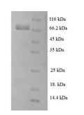 Recombinant Human Leucine-rich repeat-containing protein 40 (LRRC40) – Figure 1 of 1