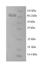 Recombinant Human Leucine-rich repeat-containing protein 40 (LRRC40) – Figure 1 of 1