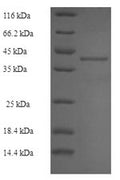 Recombinant Mouse Ribosyldihydronicotinamide dehydrogenase [quinone] (Nqo2) – Figure 1 of 1