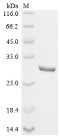 (Tris-Glycine gel) Discontinuous SDS-PAGE (reduced) with 5% enrichment gel and 15% separation gel.