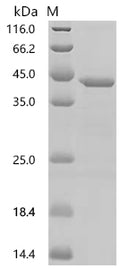 (Tris-Glycine gel) Discontinuous SDS-PAGE (reduced) with 5% enrichment gel and 15% separation gel.