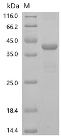 (Tris-Glycine gel) Discontinuous SDS-PAGE (reduced) with 5% enrichment gel and 15% separation gel.