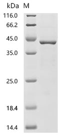 (Tris-Glycine gel) Discontinuous SDS-PAGE (reduced) with 5% enrichment gel and 15% separation gel.