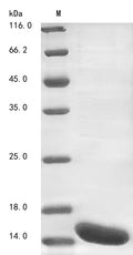 (Tris-Glycine gel) Discontinuous SDS-PAGE (reduced) with 5% enrichment gel and 15% separation gel.