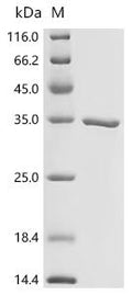 (Tris-Glycine gel) Discontinuous SDS-PAGE (reduced) with 5% enrichment gel and 15% separation gel.