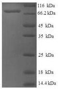 Recombinant Human Set1/Ash2 histone methyltransferase complex subunit ASH2 (ASH2L) – Figure 1 of 1