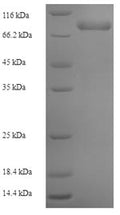 Recombinant Human DNA polymerase subunit gamma-2, mitochondrial (POLG2) – Figure 1 of 1